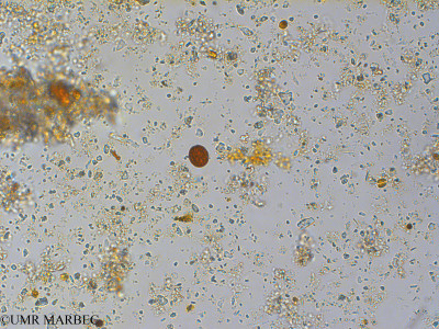 phyto/Pertuis Charentais/Tasdon_st6/PAMPAS 2019-2021/Trachelomonas sp (TASDON_St6_r1_221119-003).tif(copy)_thumb.jpg